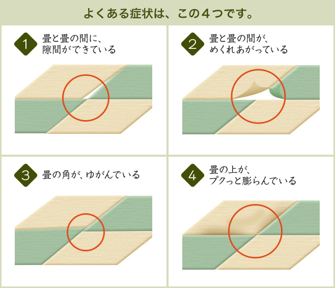 よくある症状は、この4つです。